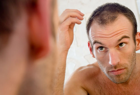 hair loss