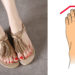 Foot Shapes
